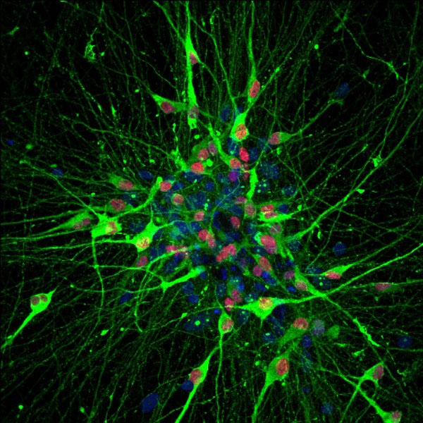 Zhang stem cells