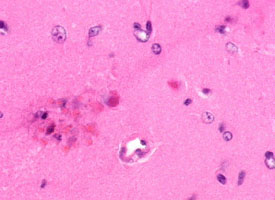 Example of H&E Stain