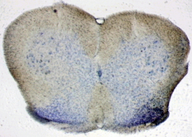 Example of Cresyl Violet Stain