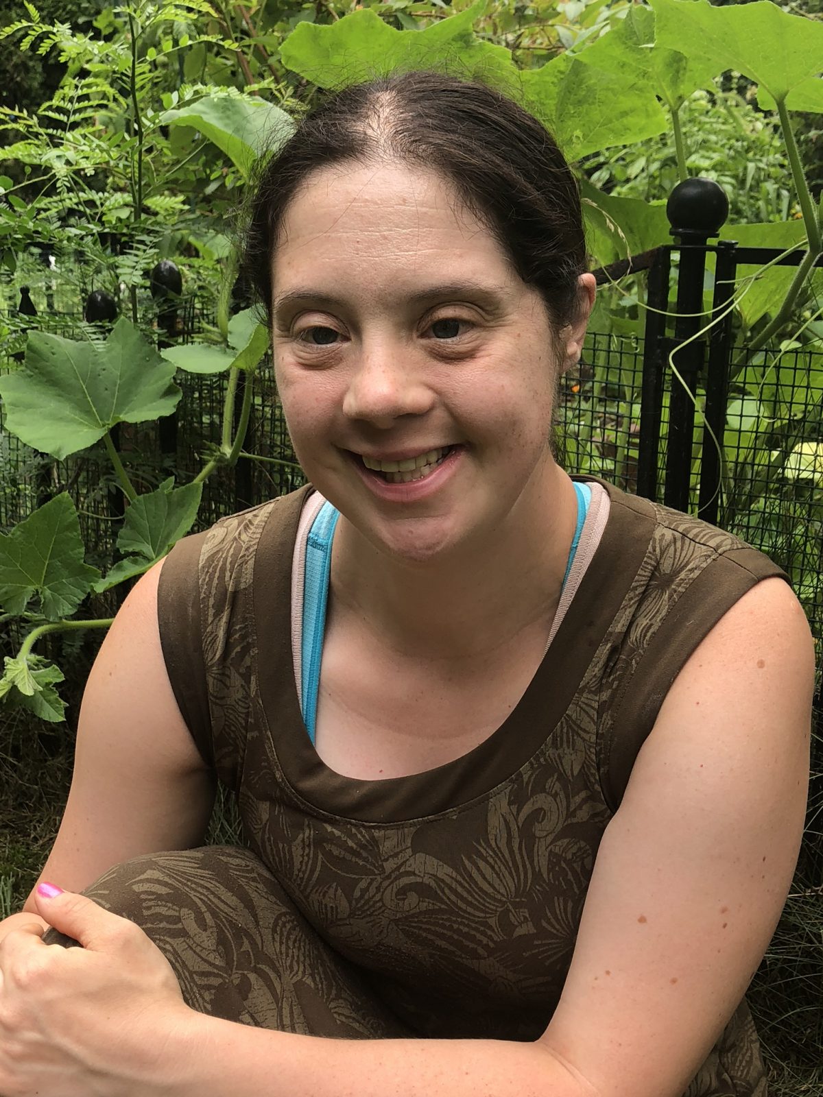The Journey To Healthy Weight: Supporting Skinny Individuals With Down Syndrome - mhu646d