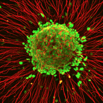 ALS stem cell