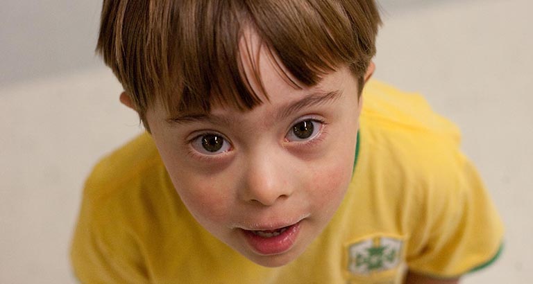 Young man with down syndrome.
