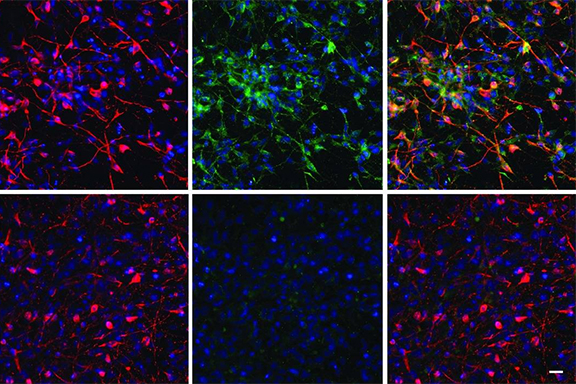 Image of FXS and control iPSCs derived neurons