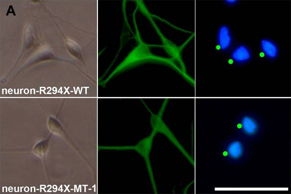 Representative images of neurons derived from iPSCs