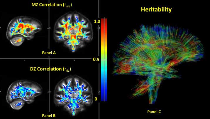 White matter structure in twins