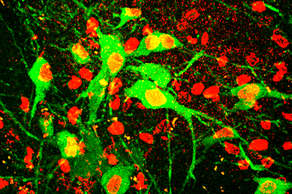 Neurons in Hippocampus - Zhang