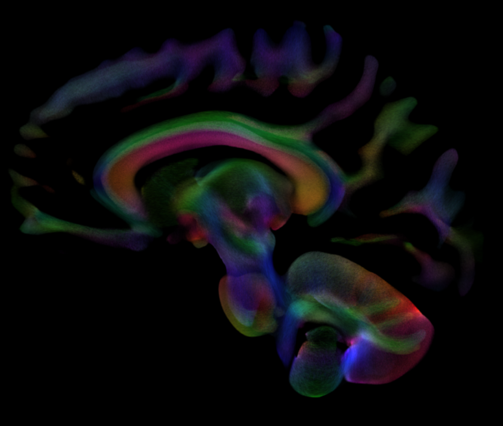 Travers brain image