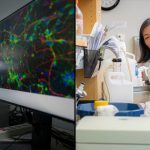 New Department of Defense Grant to Study Fragile X Syndrome in Human Cells