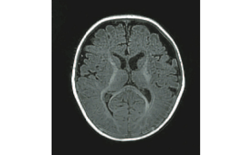 MRI scan of a typically developing infant brain