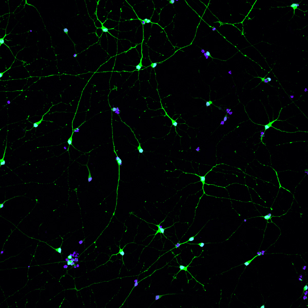 Neurons derived from stem cells of individuals with fragile X syndrome