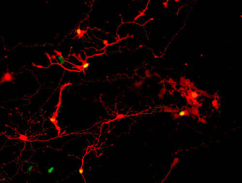 Retinal cells derived from human pluripotent stem cells