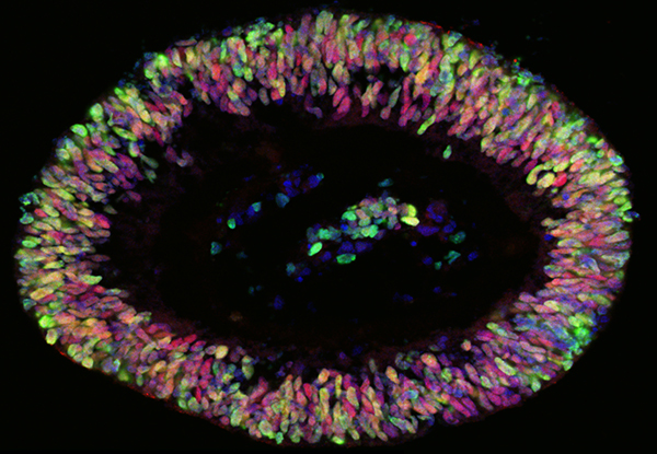 Image of the early 3-D retinal structures generated by David Gamm and his lab