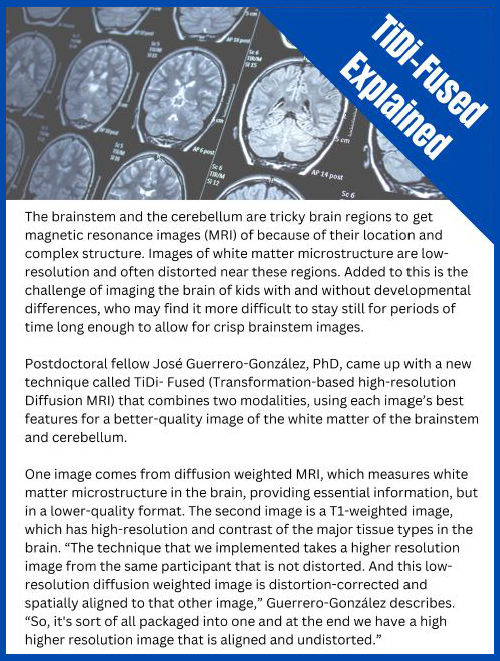 Brain stem information - click on image to view accessible pdf
